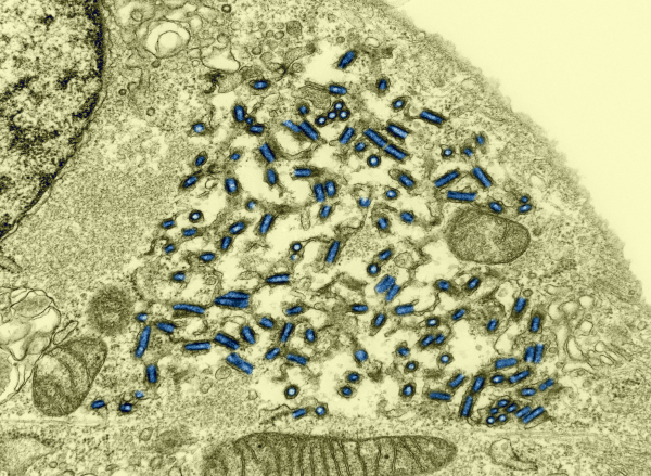 Image prise au microscope électronique puis colorisée, et trouvée sur Wikimédia Commons, de virus de la rage en train d'infecter une cellule. Le cytoplasme de la cellule en question occupe la plus grande partie de l'image, et les trucs bleus qui semblent s'accumuler à l'intérieur sont les virus, qui sont donc beaucoup trop petits pour que les instruments disponibles à l'époque de Pasteur nous permettent de les visualiser ainsi.