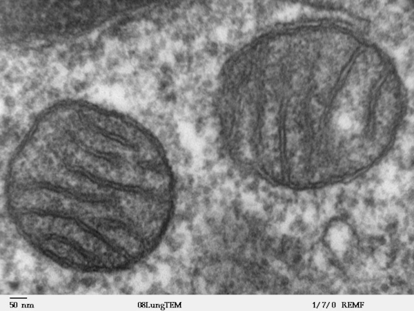 Vue de deux mitochondries au microscope électronique, trouvée sur Wikimédia Commons. Il s'agit de deux petites formes qui se détachent nettement de leur environnement, et à l'intérieur desquelles on peut distinguer quelques structures. Sans contexte, on pourrait effectivement se dire qu'on est face à deux cellules dans leur milieu extérieur, mais ce qui tient lieu de milieu extérieur est ici l'intérieur d'une autre cellule.