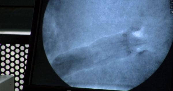 Autre capture d'écran du même documentaire, quelques secondes plus tard, où l'on voit une image aux rayons X d'une taupe commune en train de creuser la terre avec son mouvement latéral. Un autre chercheur, qui n'apparaît pas ici, nous explique ensuite (gestes à l'appui) la différence entre les façons de creuser de ces deux taupes. Je précise que ces images proviennent d'une séquence qui a malheureusement été coupée dans la version courte, donc bon, si vous pouvez, voyez plutôt la version longue.