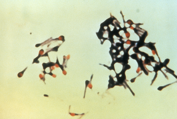 Photo prise au microscope, et trouvée sur Wikimédia Commons, d'un groupe de bactéries Clostridium tetani, donc de la famille qui provoque le tétanos. Leur forme générale « de raquette de tennis » est semble-t-il assez caractéristique. Notons qu'il s'agit ici d'une bactérie, et pas d'un virus comme dans les dernières images de ce genre que je vous ai montré : à la fin de l'épisode d'Il était une fois la vie dont j'ai utilisé quelques images dans ce thread, l'enfant est guéri par le sérum antitétanique qui neutralise les toxines, mais aussi par un antibiotique qui neutralise les bactéries elles-mêmes, les empêchant ainsi de continuer à en produire. Et ça tombe bien puisque les antibiotiques sont ce qui va nous intéresser pour le reste de ce thread.