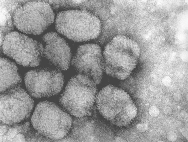 Photo, prise au microscope électronique et trouvée sur la page Wikipédia dédiée à la maladie, du virus de la variole. On voit globalement une image en noir et blanc avec un tas de petites boules, des cellules, nous permettant finalement de voir à quoi ressemble cet ennemi très longtemps resté invisible pour nous. Je vous préviens, je vais faire mon possible, mais ce thread n'est pas évident à illustrer.